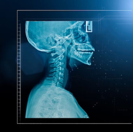 An x-ray image of a neck and skull on a black background